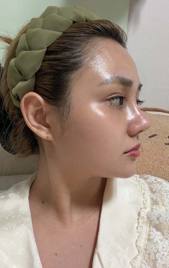 추구미였던 코가 내 코가 되는 순간!